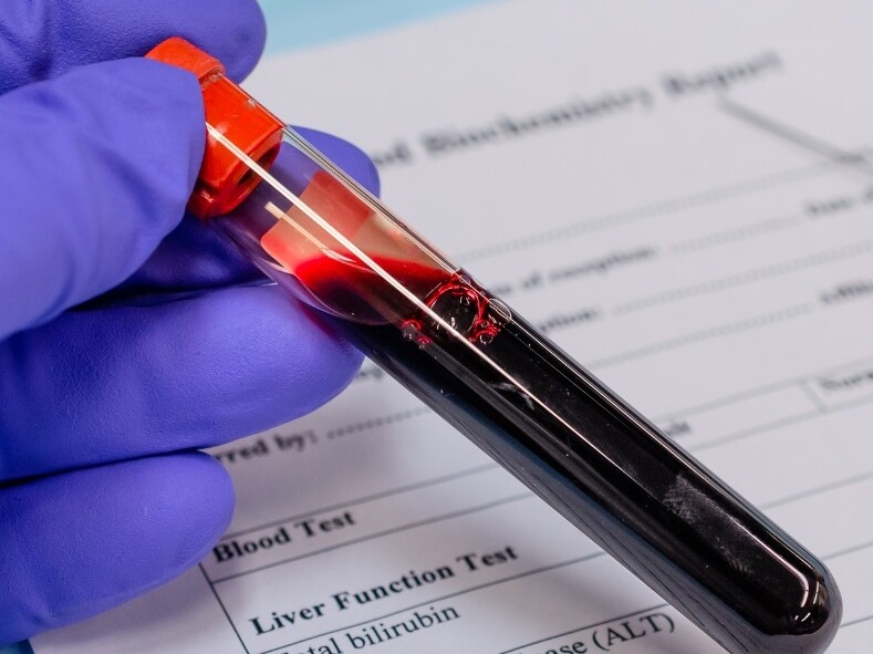 Check Up Funzionalità Epatica